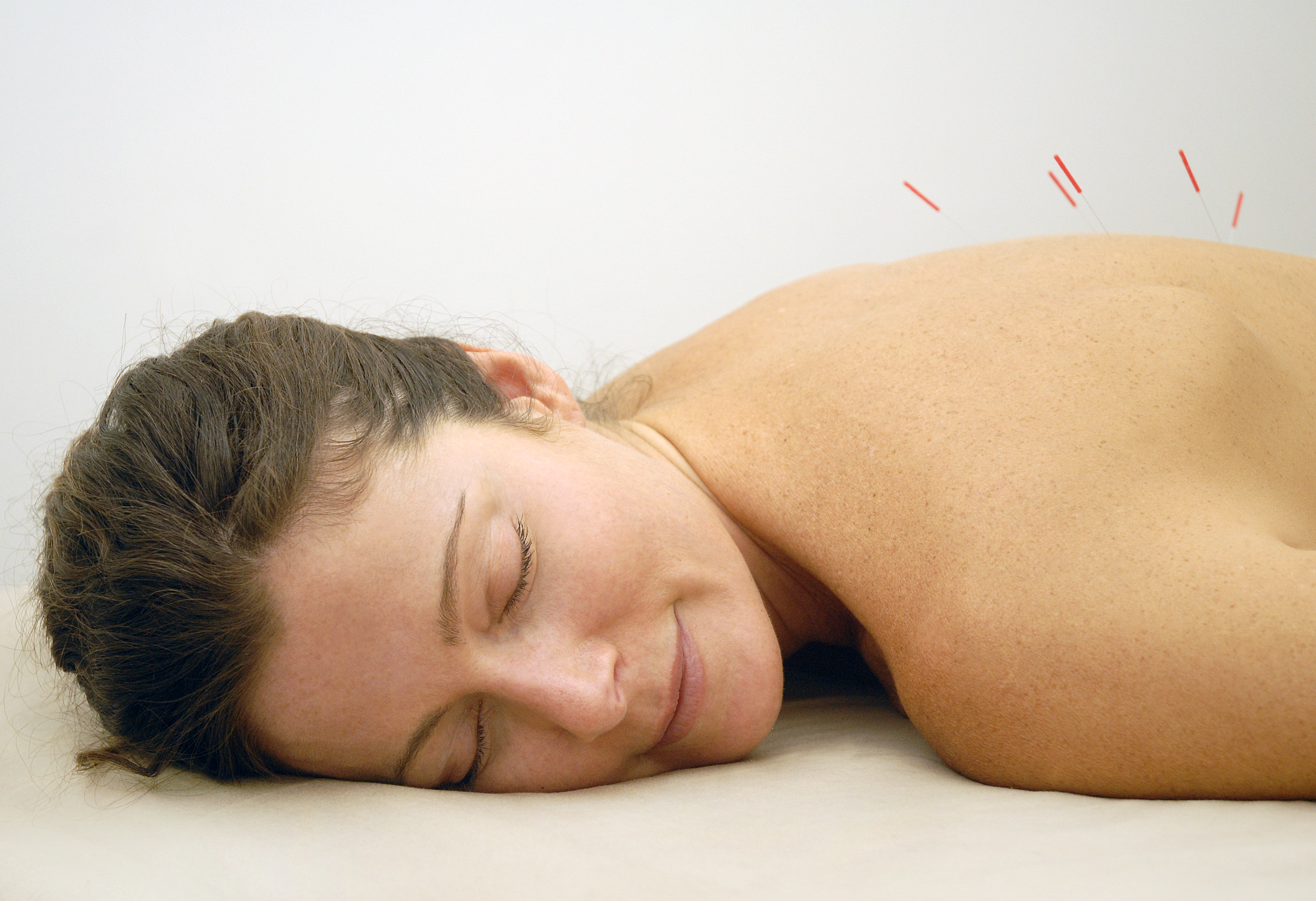 What is acupuncture graphic 1
